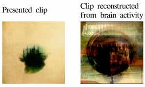 brain